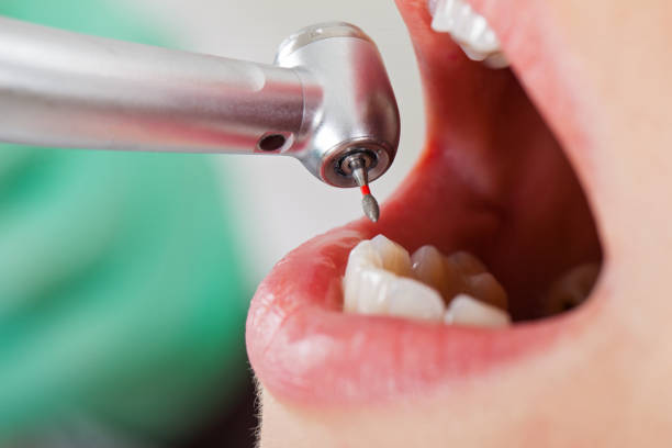 Best Broken or Chipped Tooth Repair in Brighton, AL